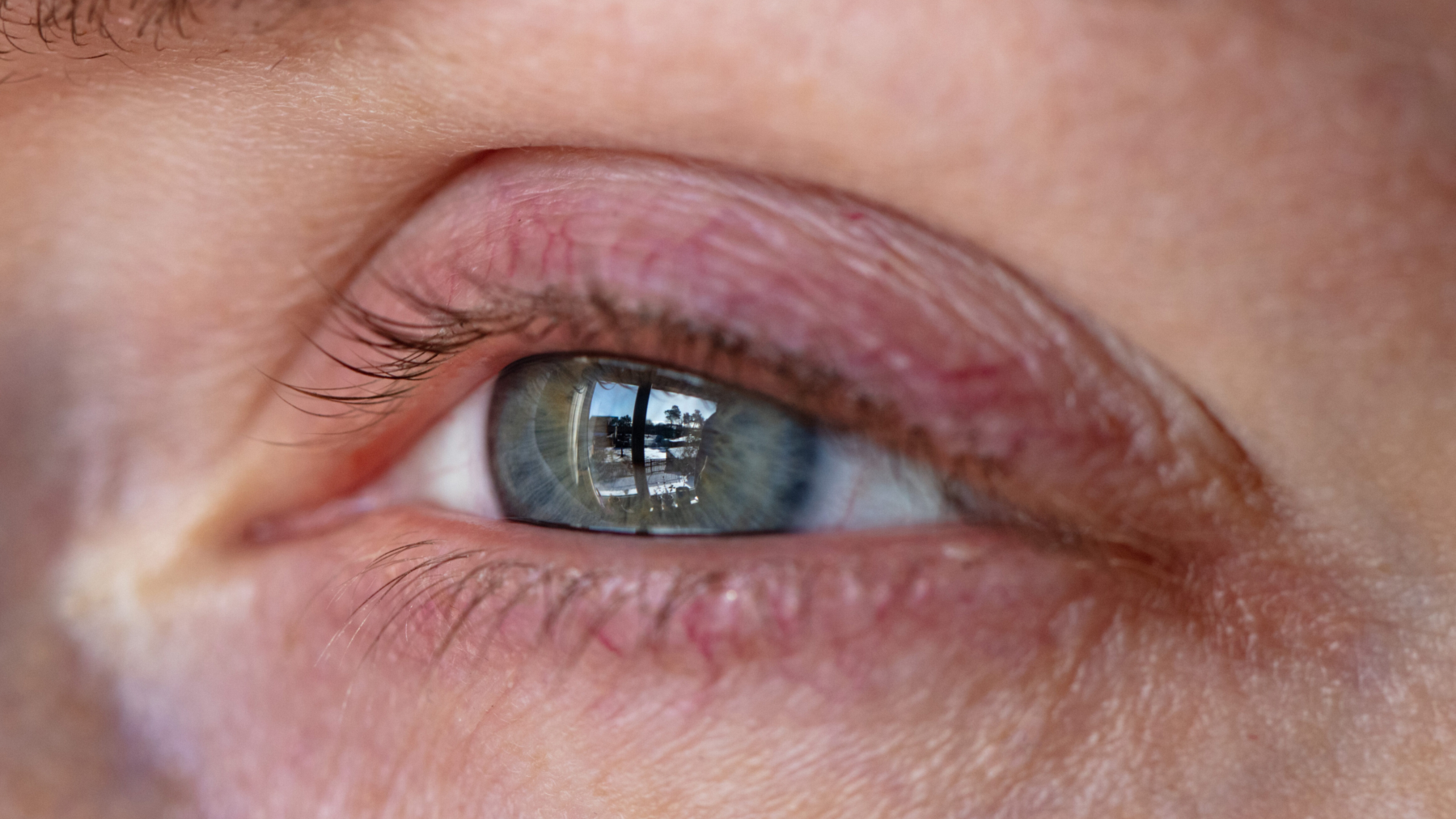 Tränende Augen by Strebel Optik